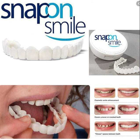 Snap on smile teeth cover