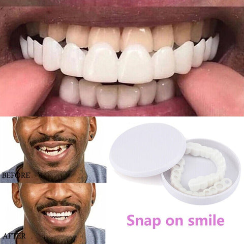 Snap on smile teeth cover